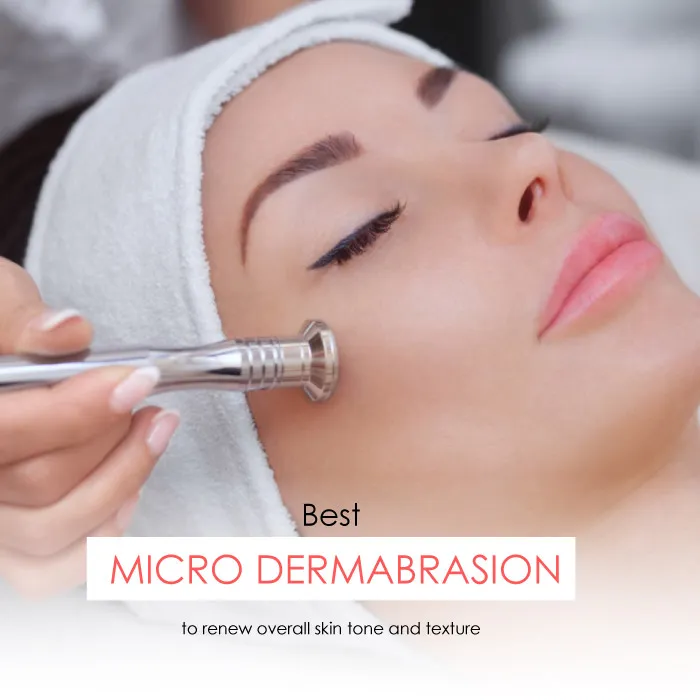 microdermabrasion treatment