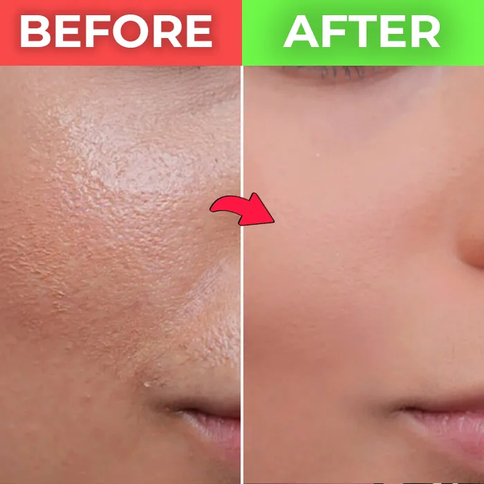 large pores before and after